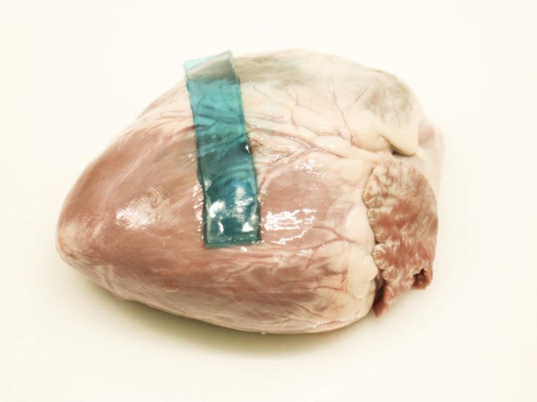 Investigadores Encontraron Nuevo Adhesivo Biomédico Inspirado por Babosa