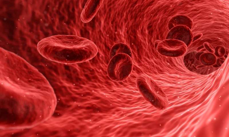 Nuevo estudio concluye que la altura podría ser un factor de riesgo para las venas varicosas veins